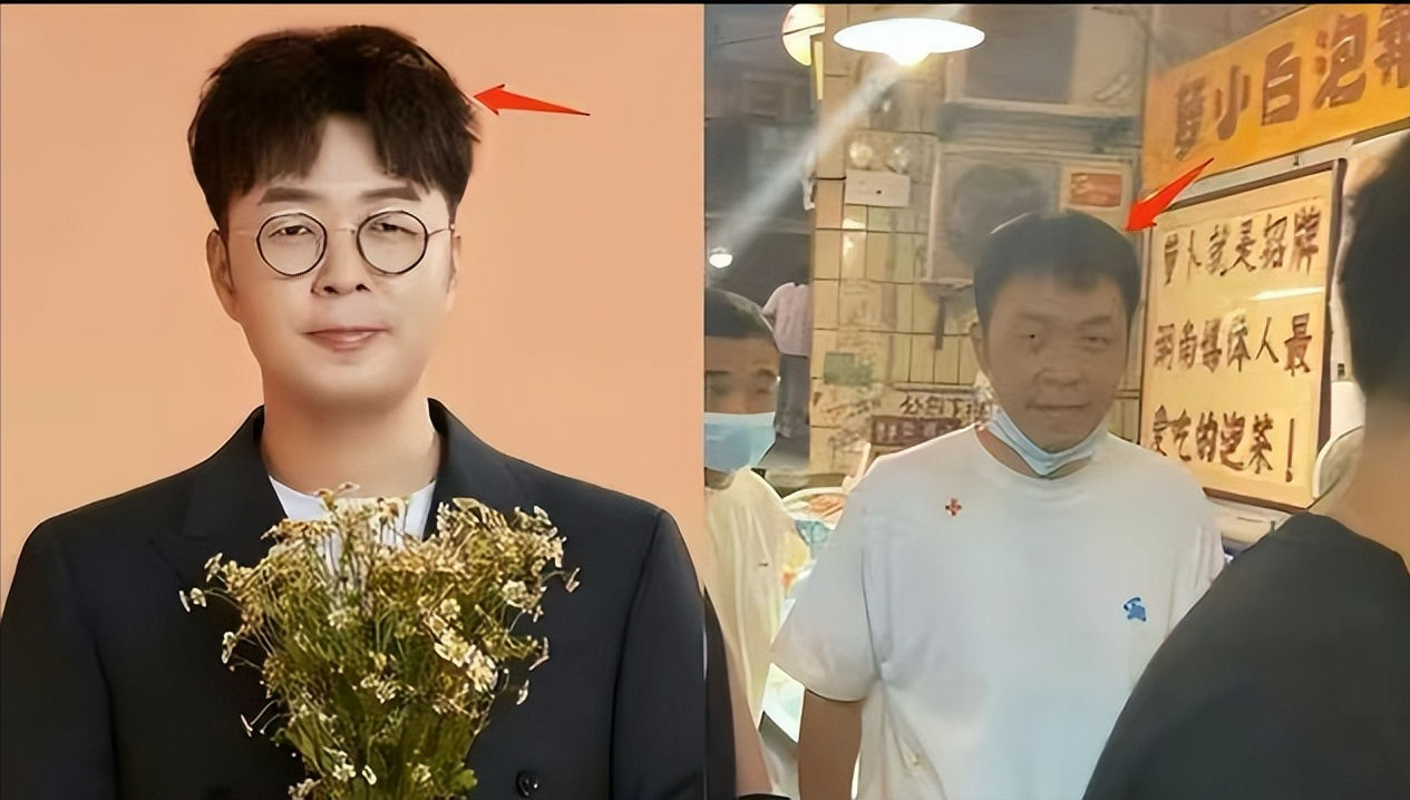 脱发健身明星会恢复吗_脱发健身明星会秃头吗_明星健身怎么不会脱发